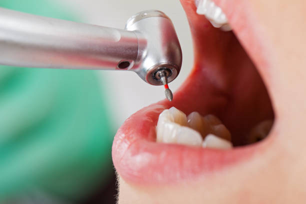 Best Emergency Root Canal Therapy in Mccleary, WA